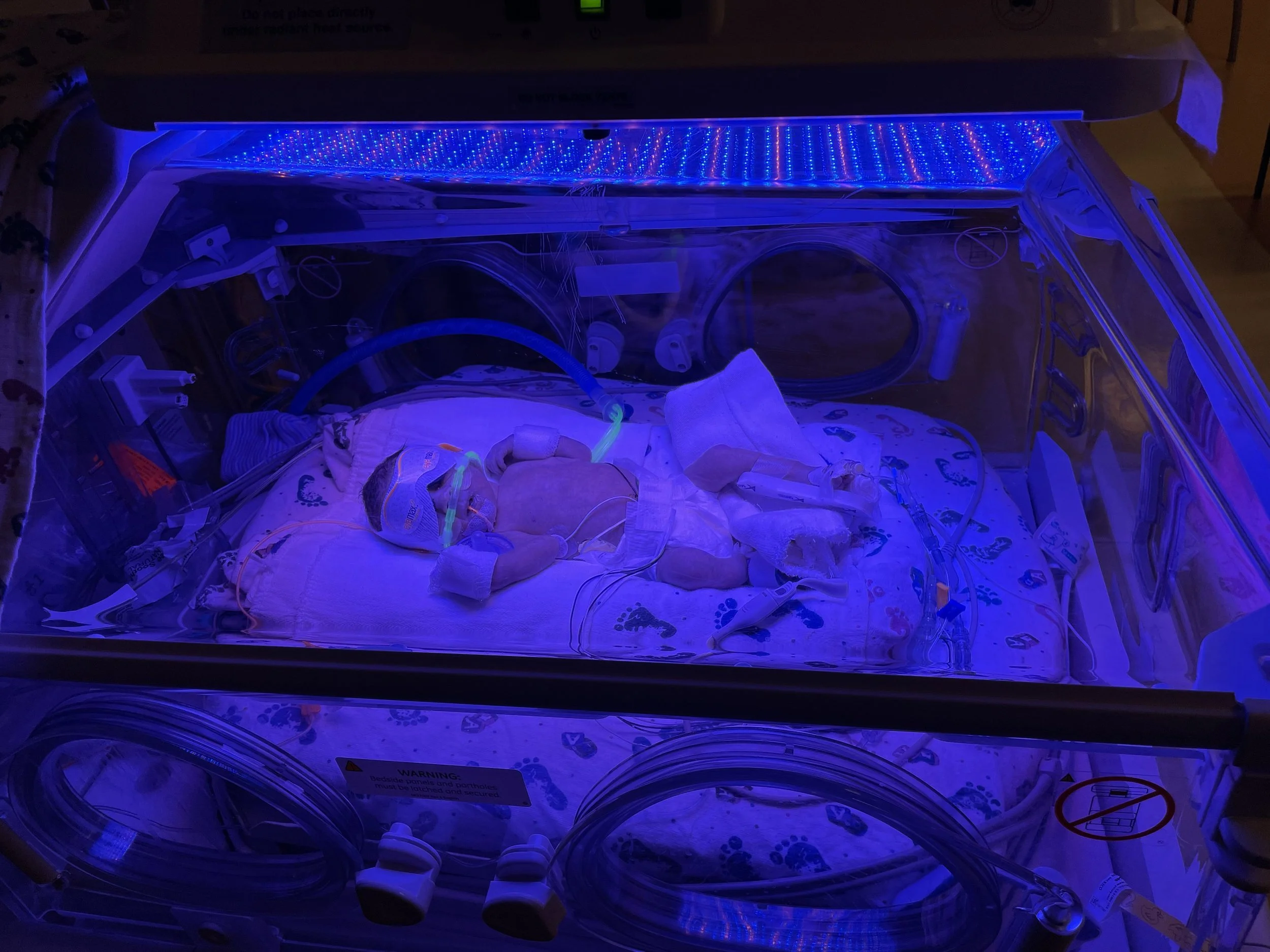Project NICU | Our NICU Chapter