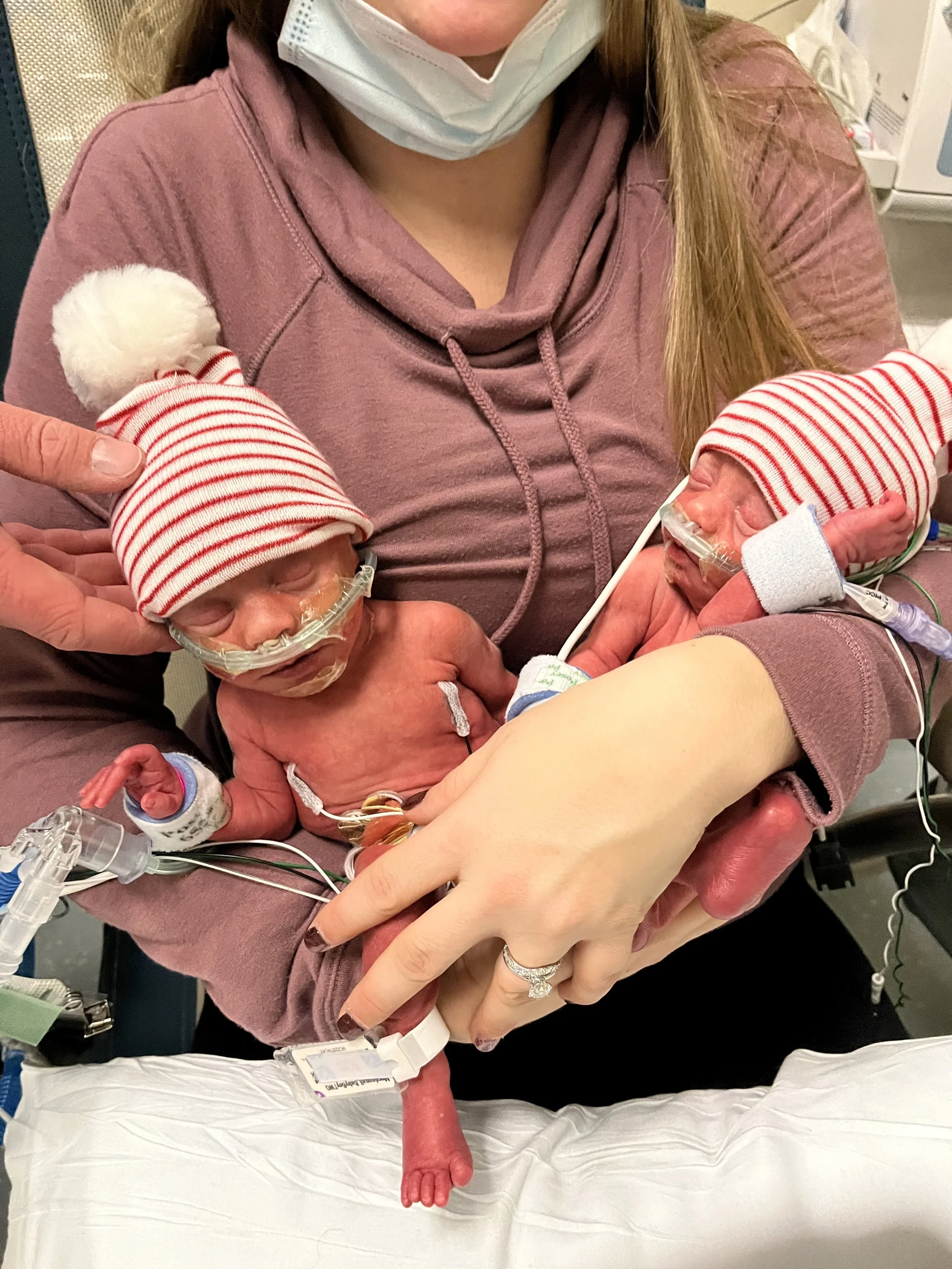      

 
   “We were referred to maternal fetal medicine practitioner where he had to inform us of the risk for TTTS, fast forward 2 weeks to the official TTTS diagnosis and finding a provider to have the procedure to save my boys.   We flew from Bos