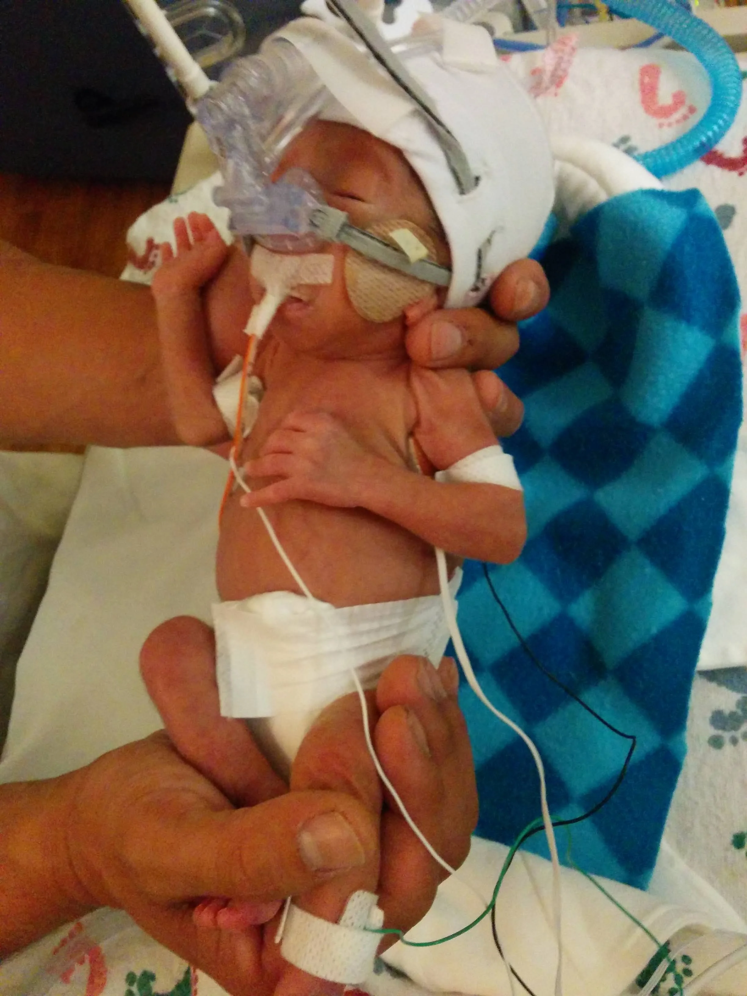 30 wks 1.16 lbs of steel