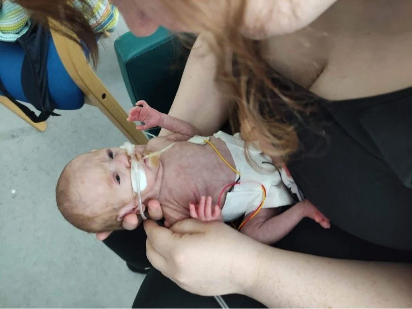      

 
   “I woke up in the morning to a wet spot in my bed. I panicked and I stood a gush of amniotic fluid came out. I phoned the pregnancy triage and said “my waters have just gone” she replied “oh congratulations come on in” but before she had 