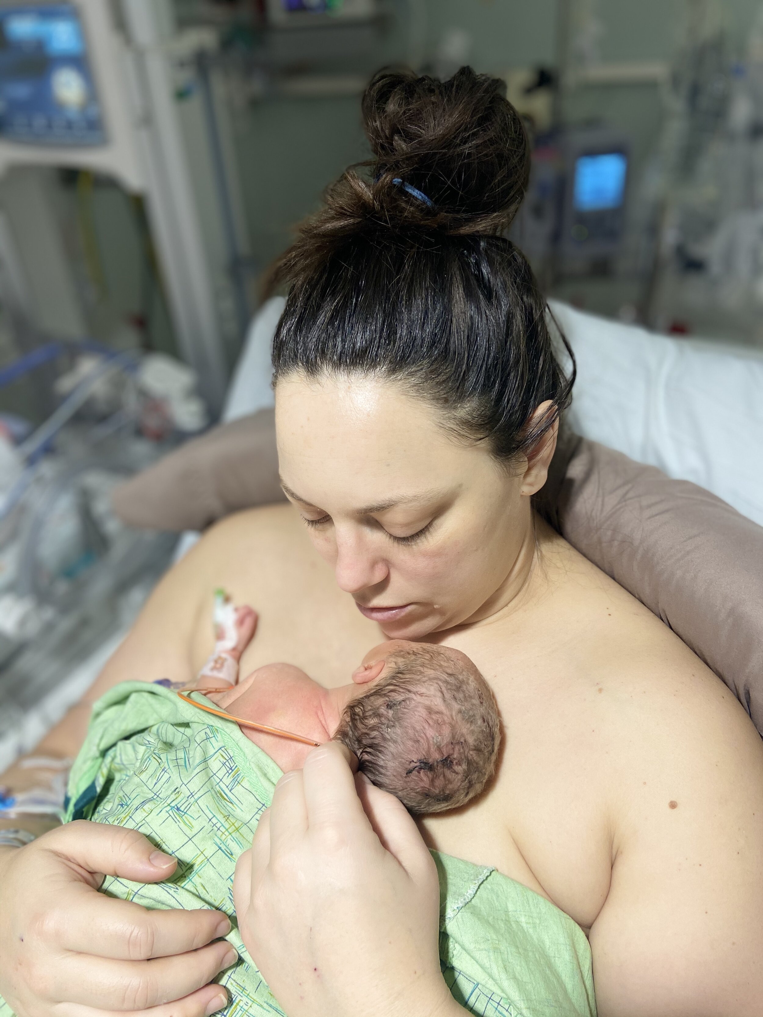 Preeclampsia &amp; HELLP Syndrome. Amy's story.