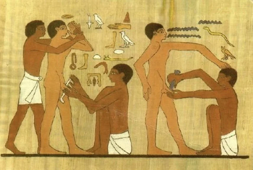The history of circumcision: From ancient rituals to modern practices