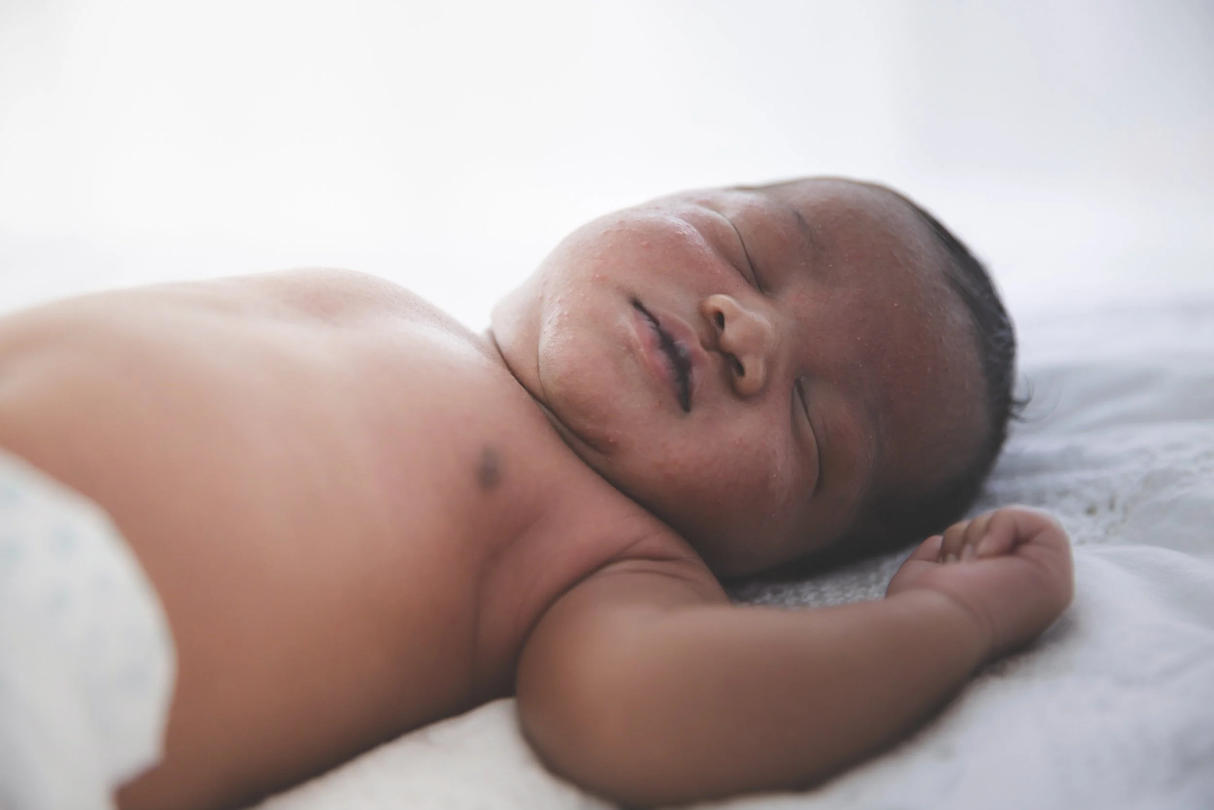 Comfort and care: Circumcision pain management for your infant