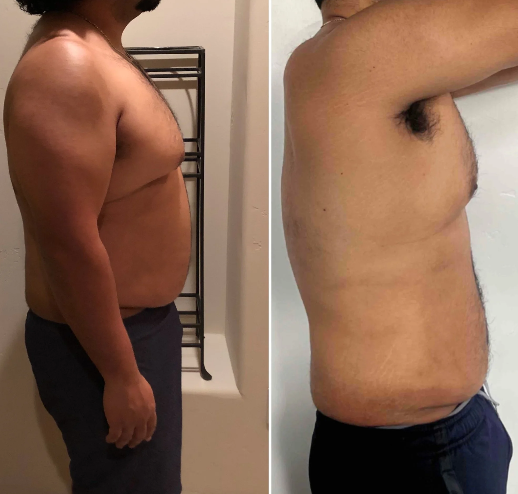Comparison of a man's side profile before and after weight loss, showing reduced body size and abdominal area.
