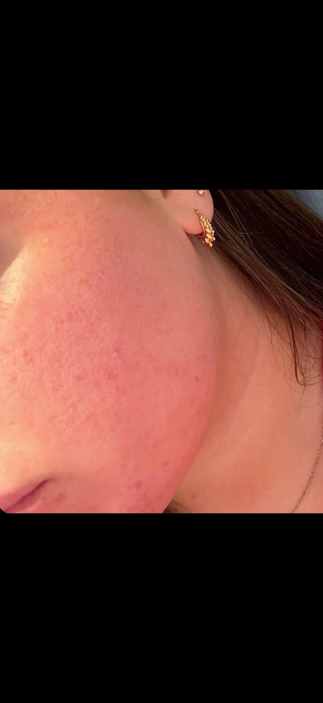 Close-up of a person's cheek, ear with gold hoop earring, and part of brown hair.