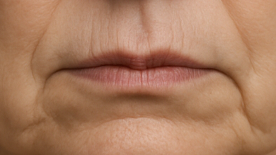 Primer plano de los labios y la zona alrededor de la boca de una persona mayor.