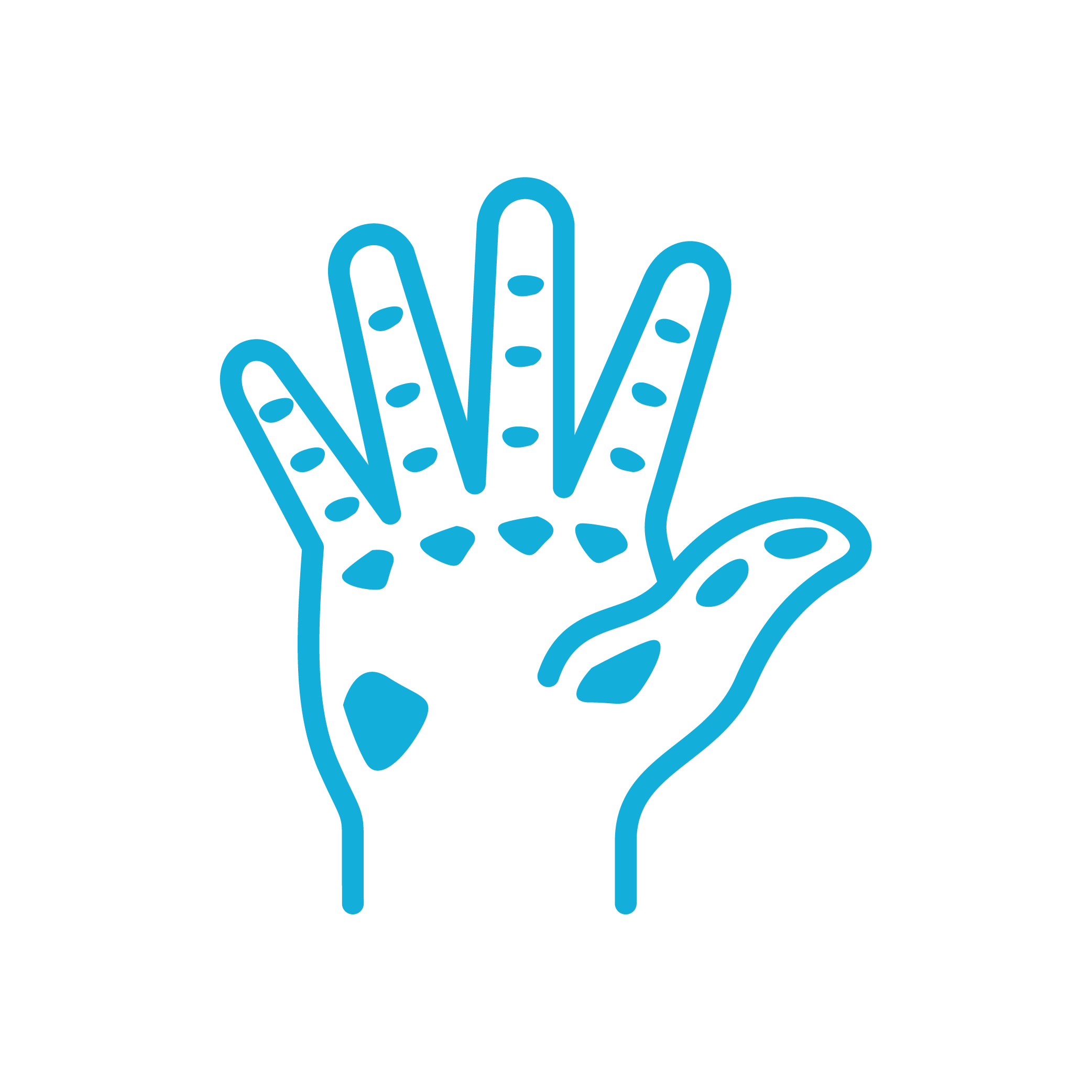 Line drawing of a hand with specific points highlighted for acupuncture or acupressure treatment, with some points marked by small dashes.