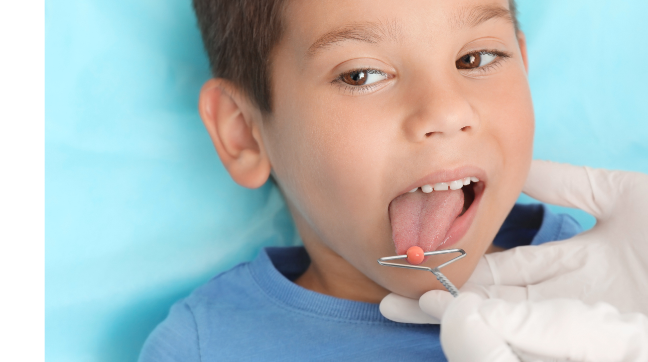 Un jeune garçon lors d'un examen bucco-facial, la langue sortie, un guide-langue dans la bouche d'un côté, dans une clinique orthophonique