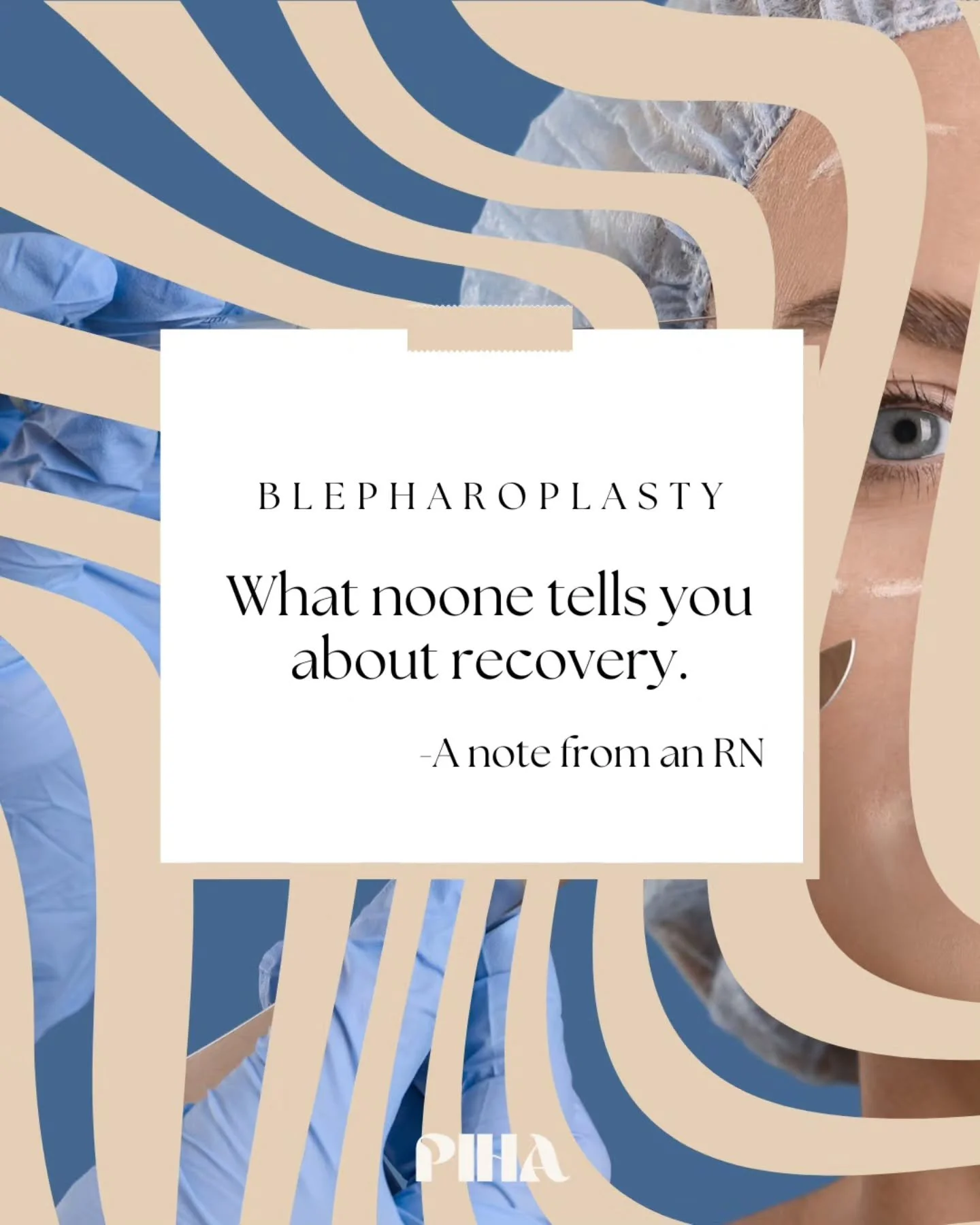 &ldquo;&hellip;when it&rsquo;s your face, nothing about it feels minor.&rdquo; Thinking about eyelid surgery? This is a must-read by Susan Groshek,RN. Her first-hand account tells us exactly what to expect during recovery...including the emotional pa
