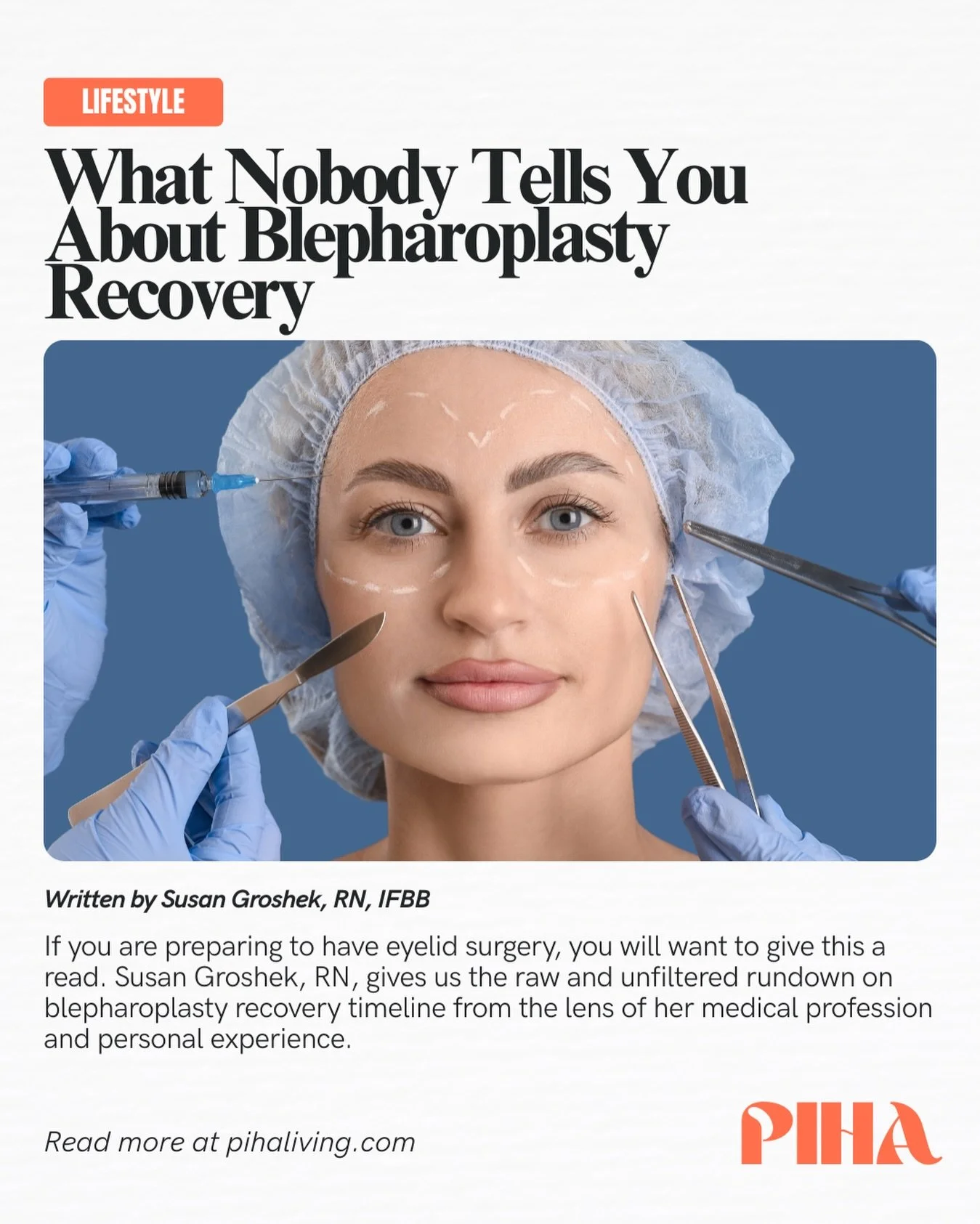 If you are preparing to have eyelid surgery, you will want to give this a read. Susan Groshek, RN, gives us the raw and unfiltered rundown on blepharoplasty recovery timeline from the lens of her medical profession and personal experience.

Tap the ?