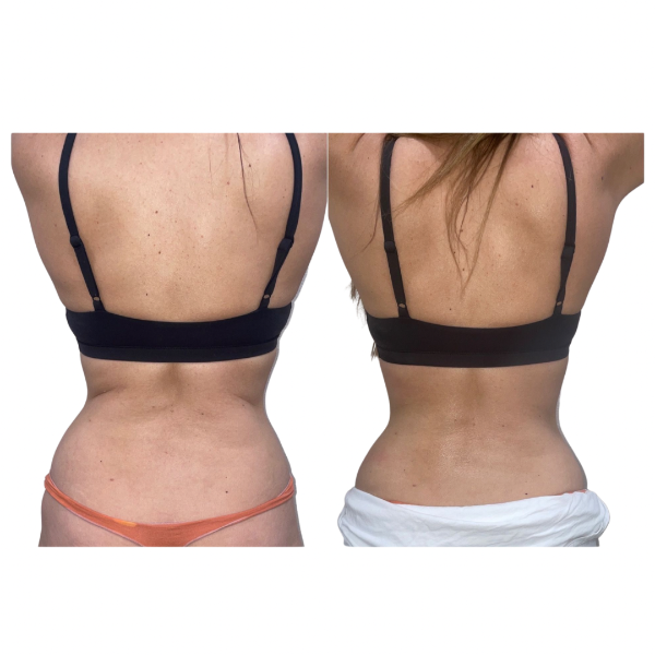 Raw Before and After (2).PNG