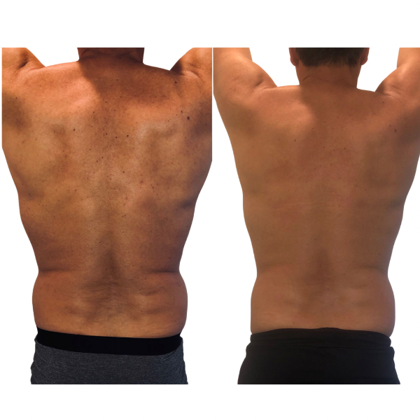 Raw Before and After (1).PNG