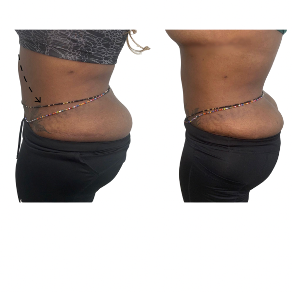 Raw Before and After (5).PNG