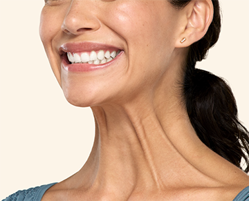 Botox-Before-Jaw-Nick-Treatment (