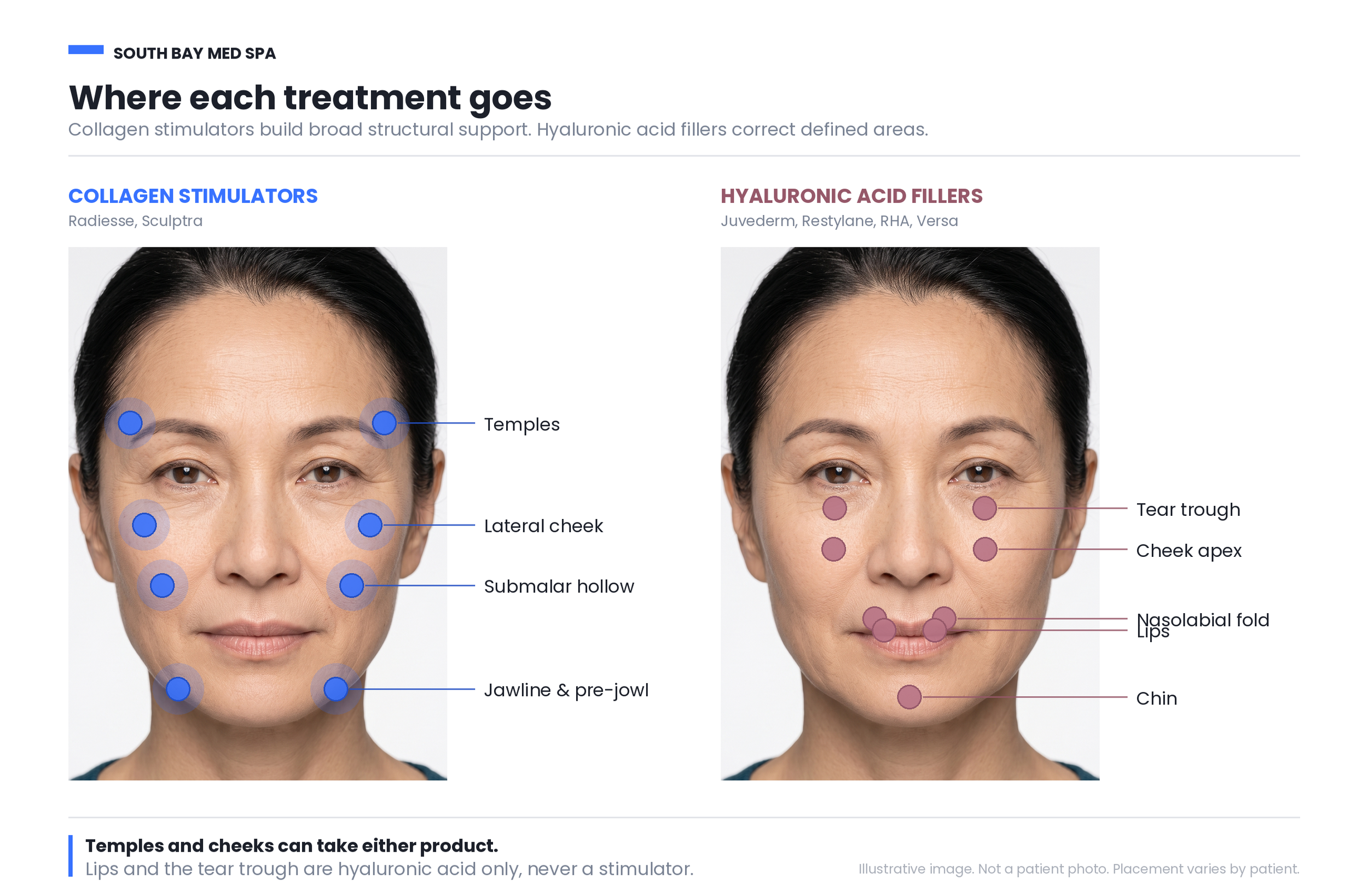 Losing volume or firmness since starting a GLP-1?