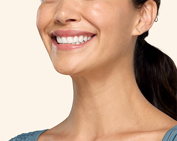 After-Botox-Jaw-Neck-Treatment  (Results may vary from patient to patient.)
