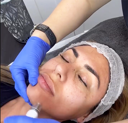 SouthbayMedSpa-DiamondGlow-Torrance