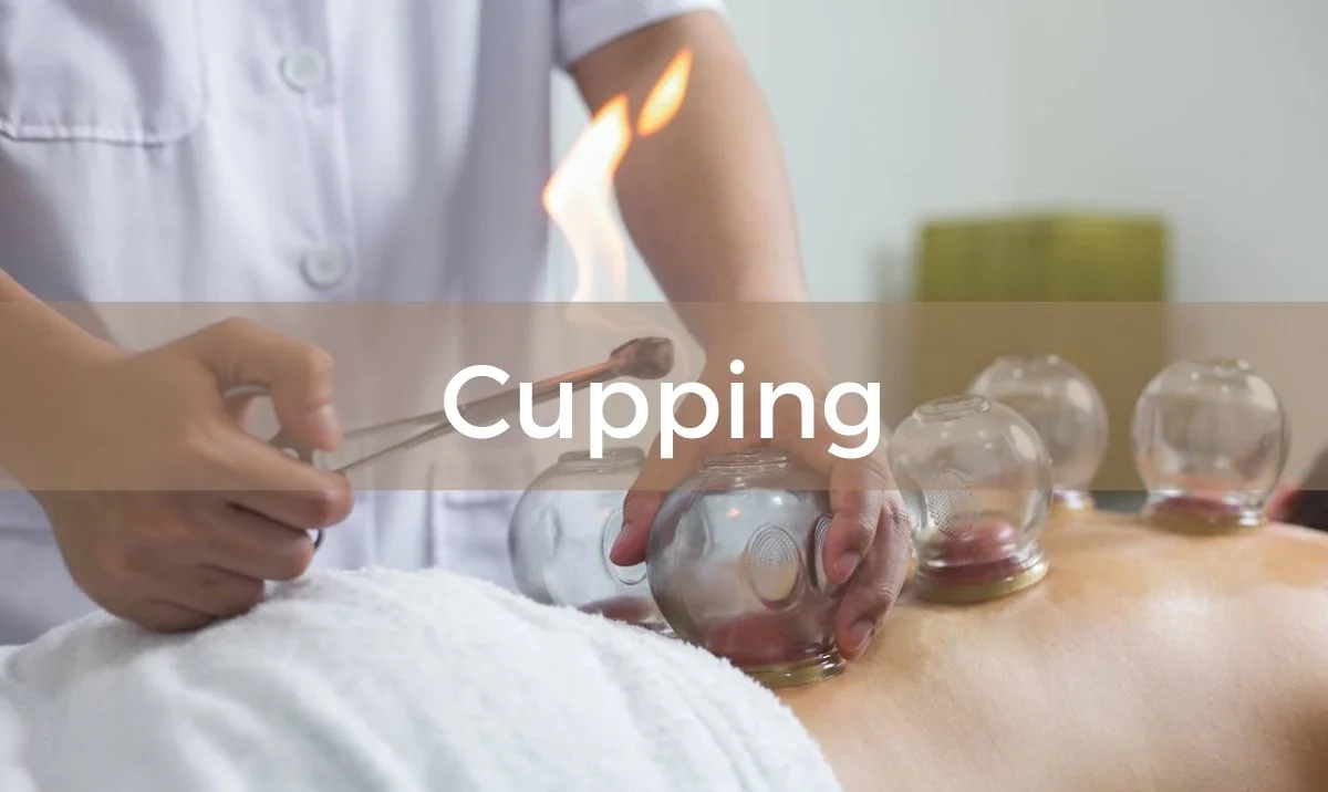 Cupping therapy session at Sota Massage Therapy Medina MN