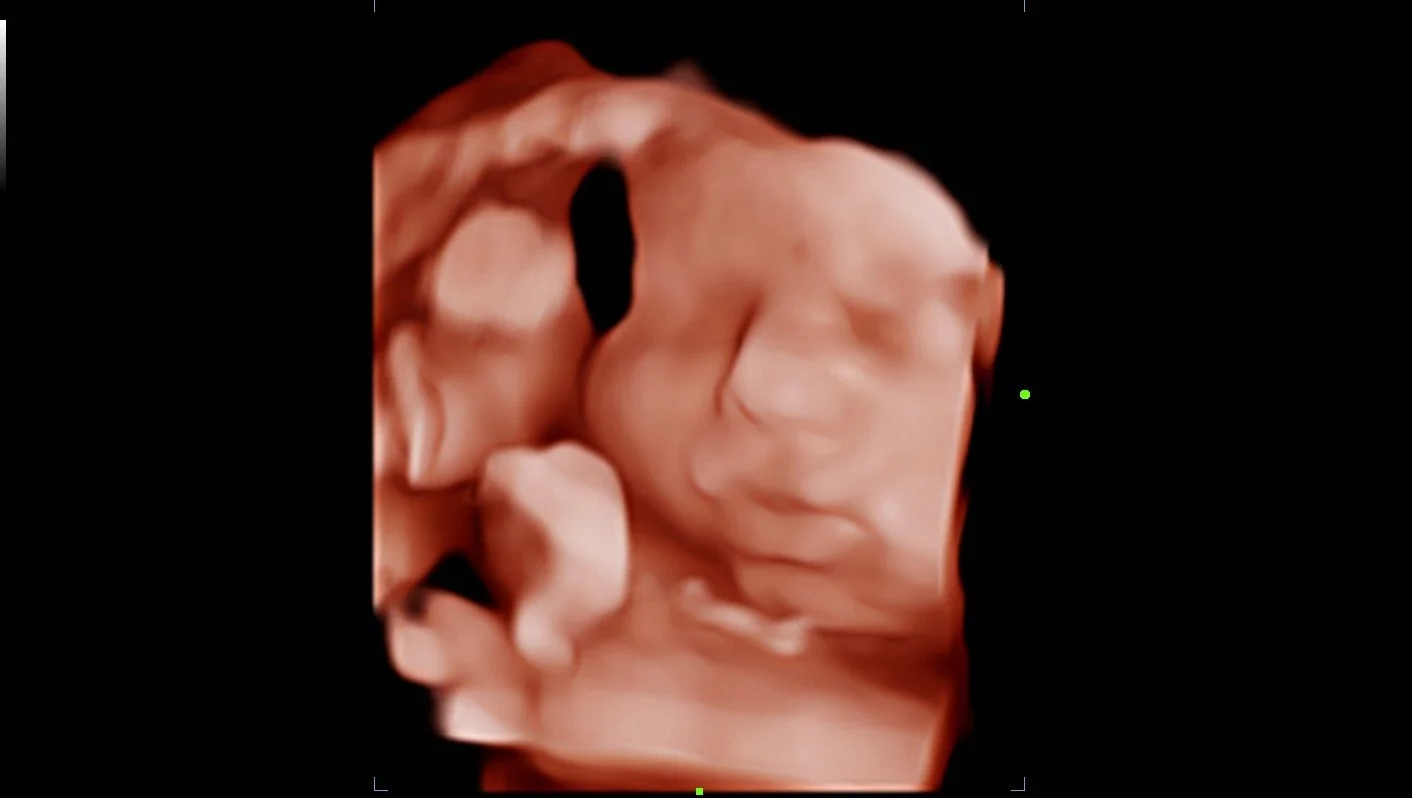 Sweet boy 35 weeks 💙