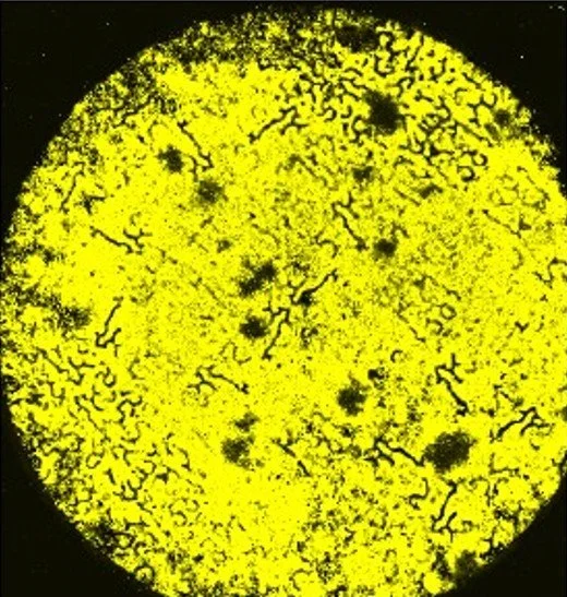 A yellow circular spherical object with black branching patterns and dark spots on its surface, resembling a microscopic view cell attachment and proliferation. biobraille.