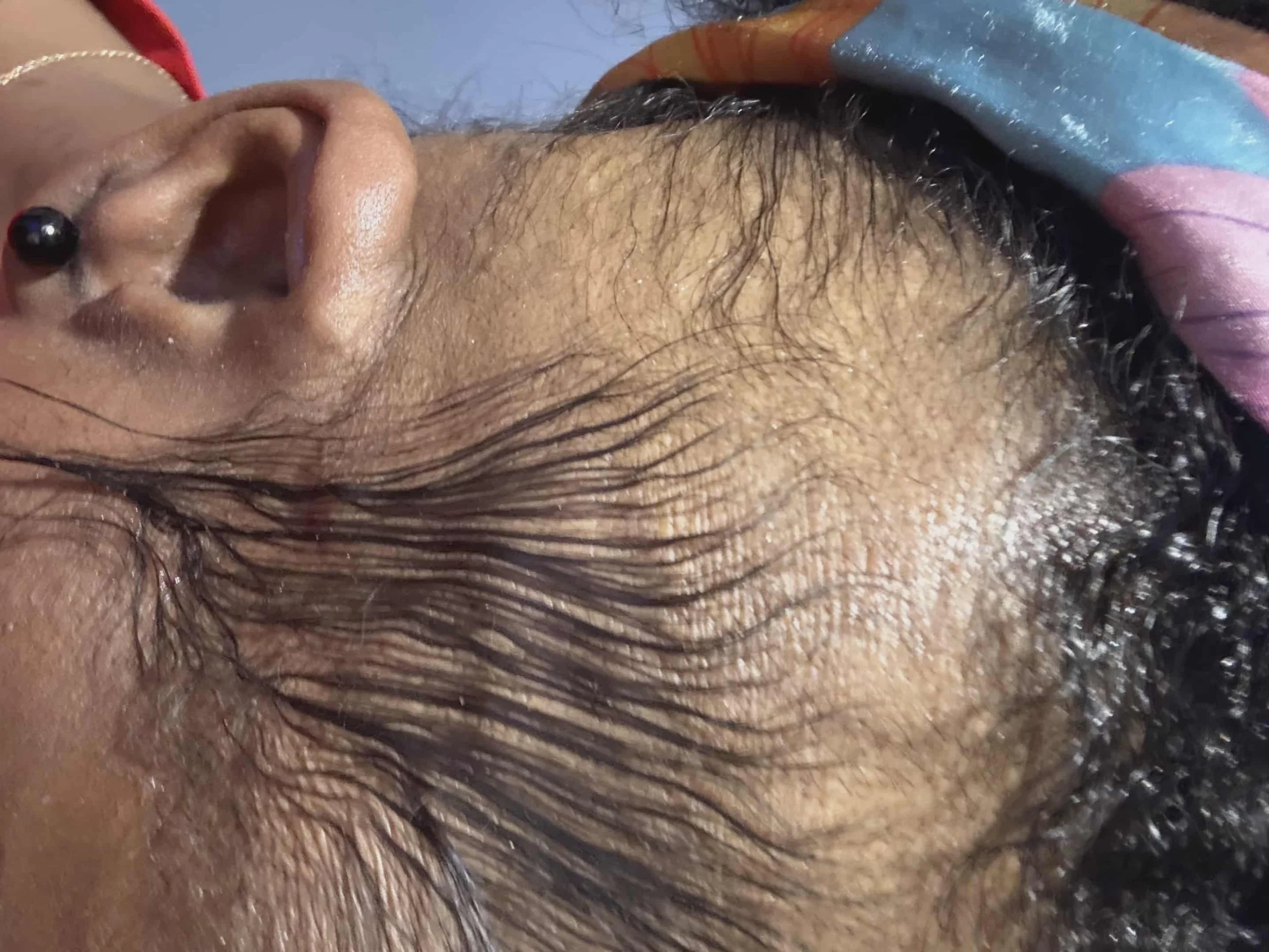 Close-up of a person’s scalp and hairline, showing dark, curly hair and a hairbrush or comb reflecting light on the scalp.