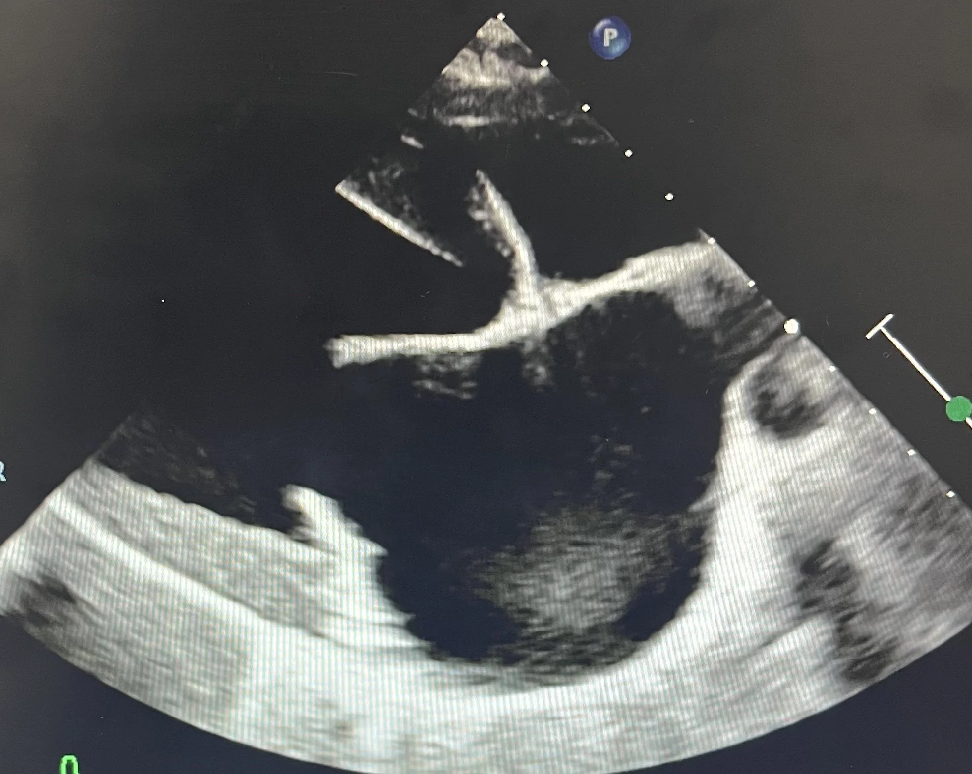 Ultrasound image of a dog's heart.