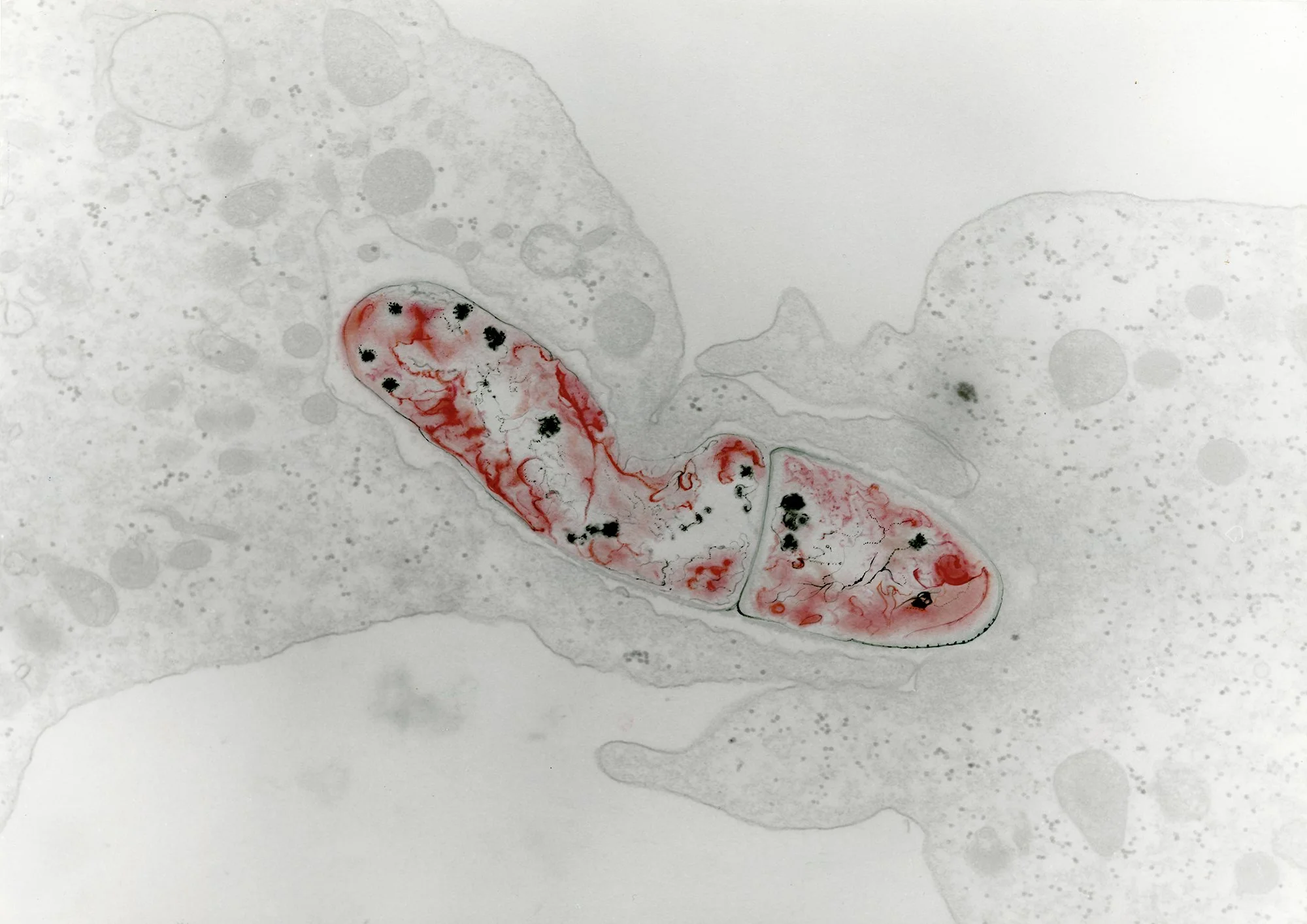 KS_Silenced-gene.jpg