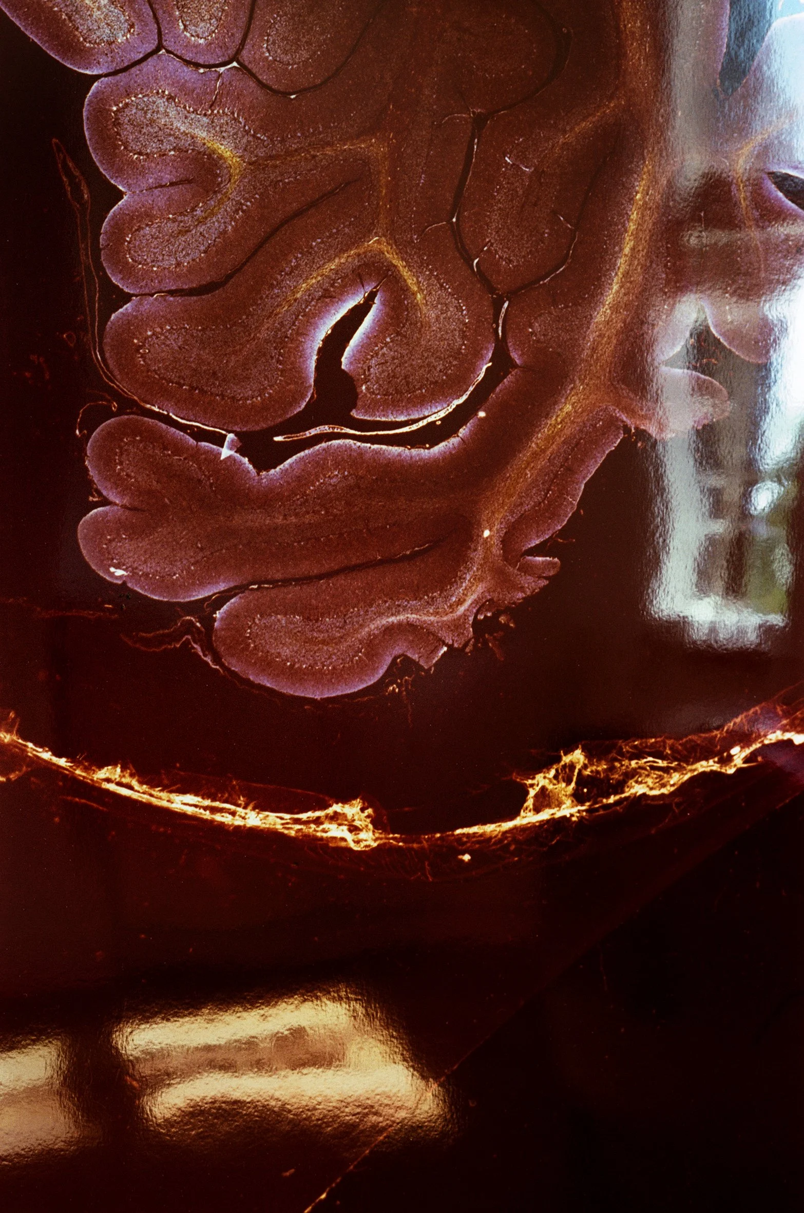 Cerebellum_02.jpg