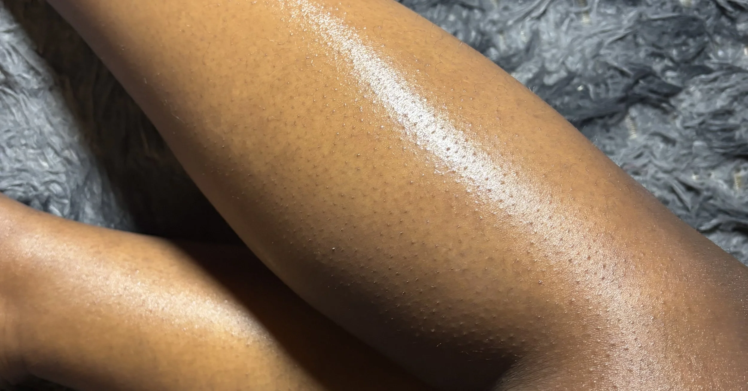 Public Health Is Obsessed With Survival—But Ignores How Women Live in Their Bodies