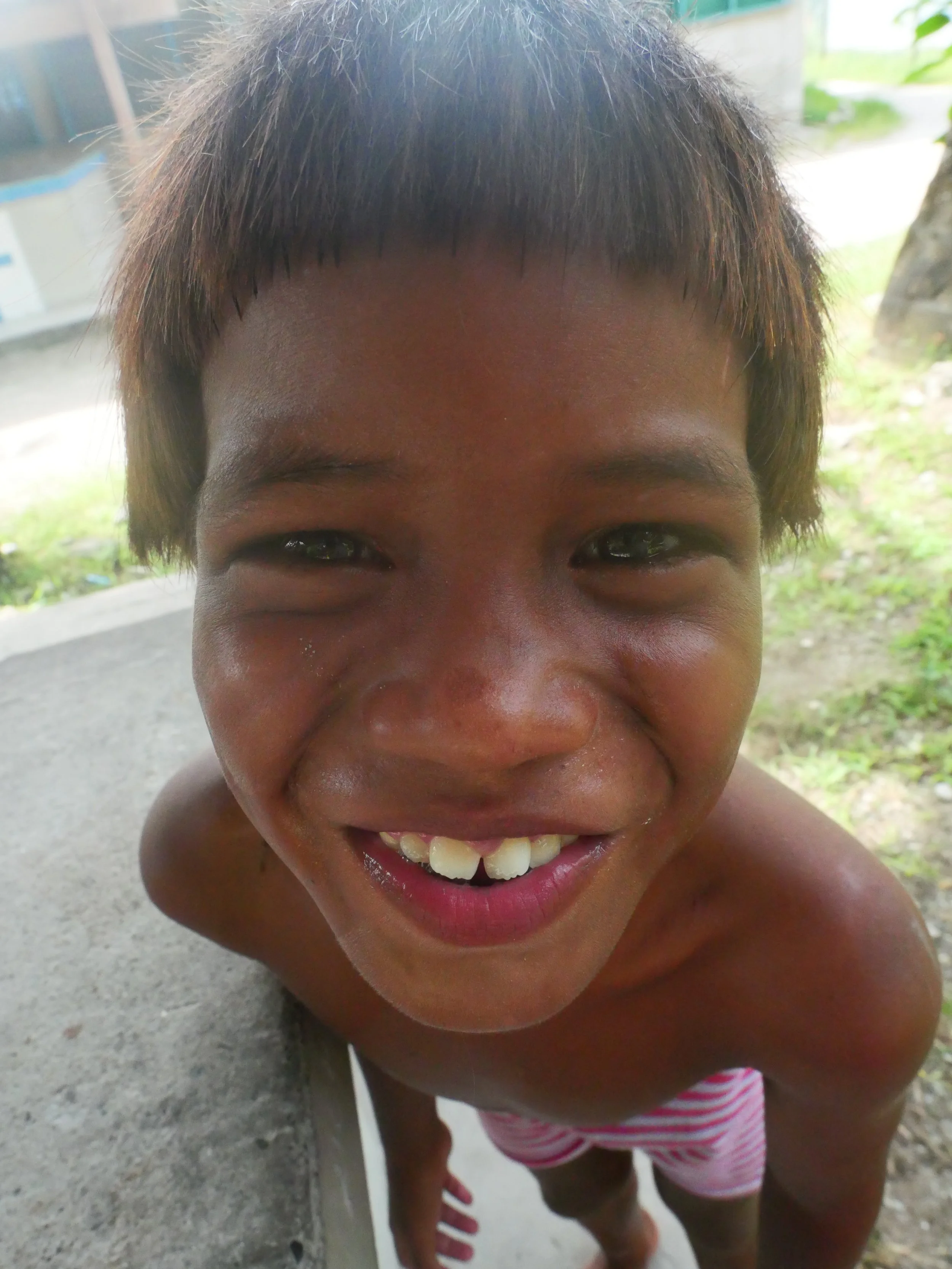 Close-up of a smiling young boy with missing front teeth, wearing pink and white striped shorts, outdoors in a sunny environment.
