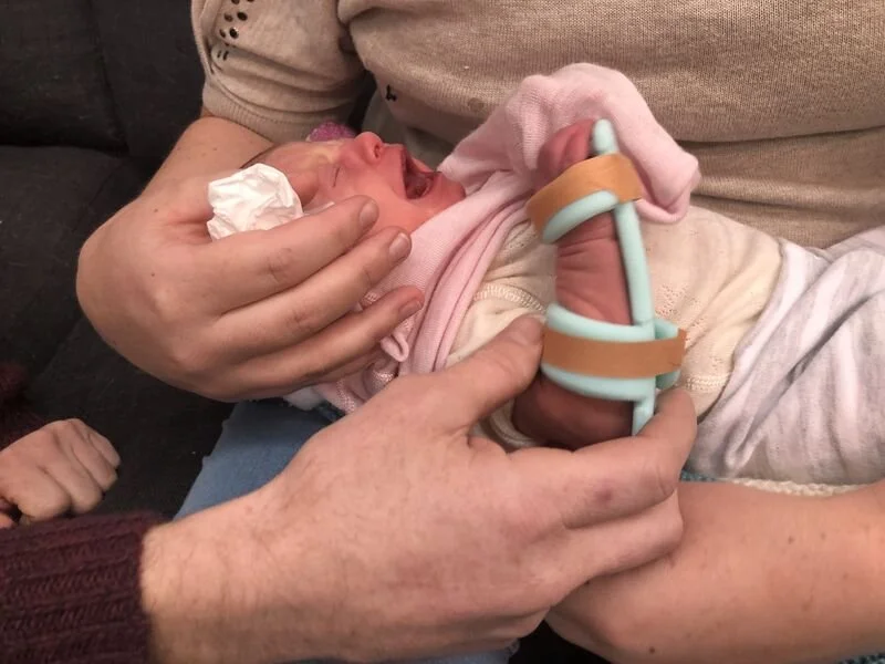 Pepi Neonatal Splint (MWDesign)