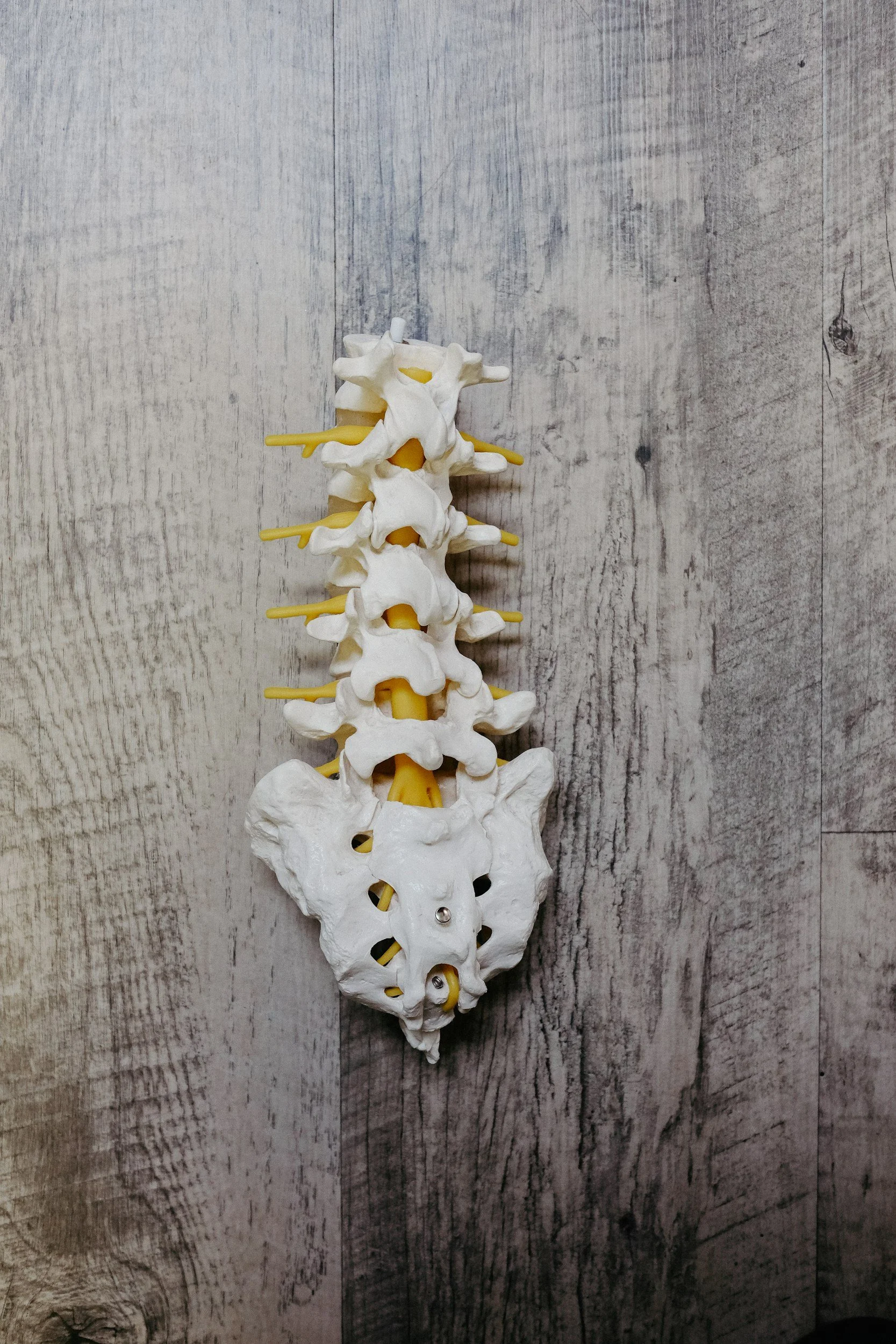 Model of the human spine, including pelvis, with yellow discs, set against a wooden background.