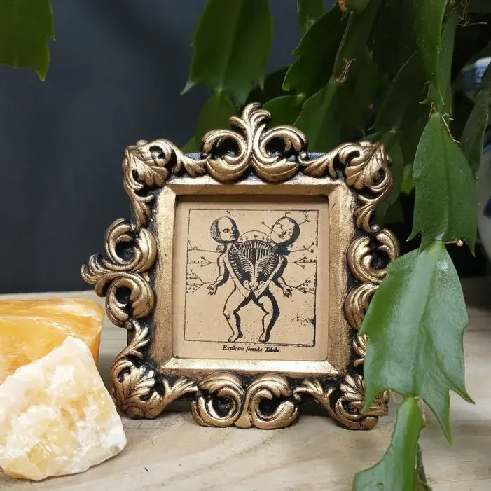 Conjoined Twin Diagram in Ornate Frame