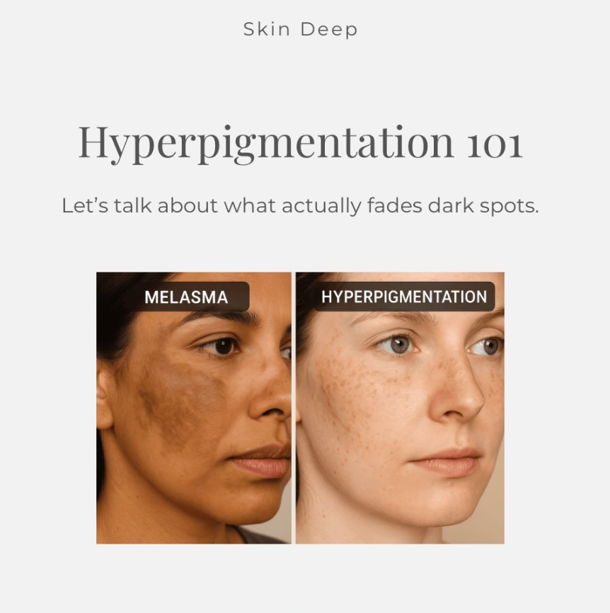 Hyperpigmentation 101