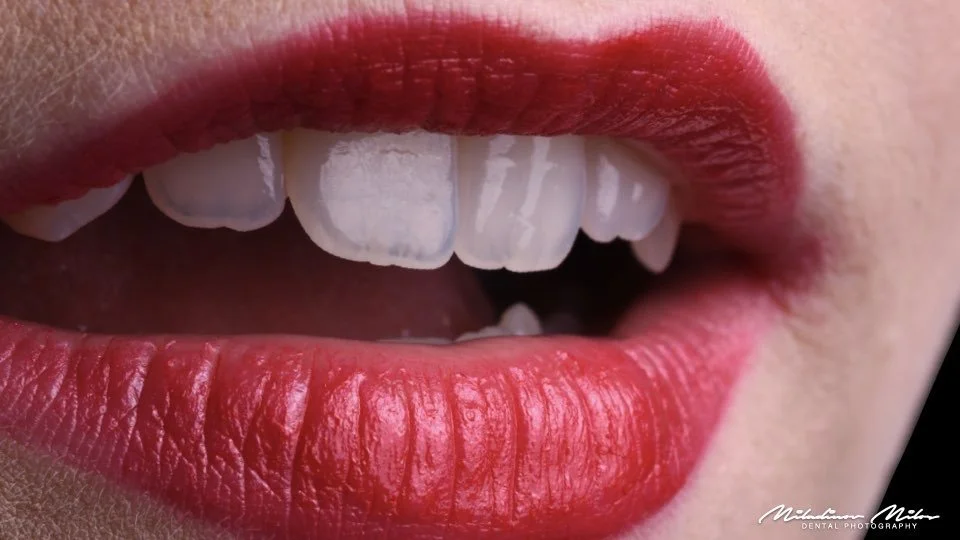 Close-up of a person's mouth with red lipstick, showing upper and lower teeth, with slightly parted lips.
