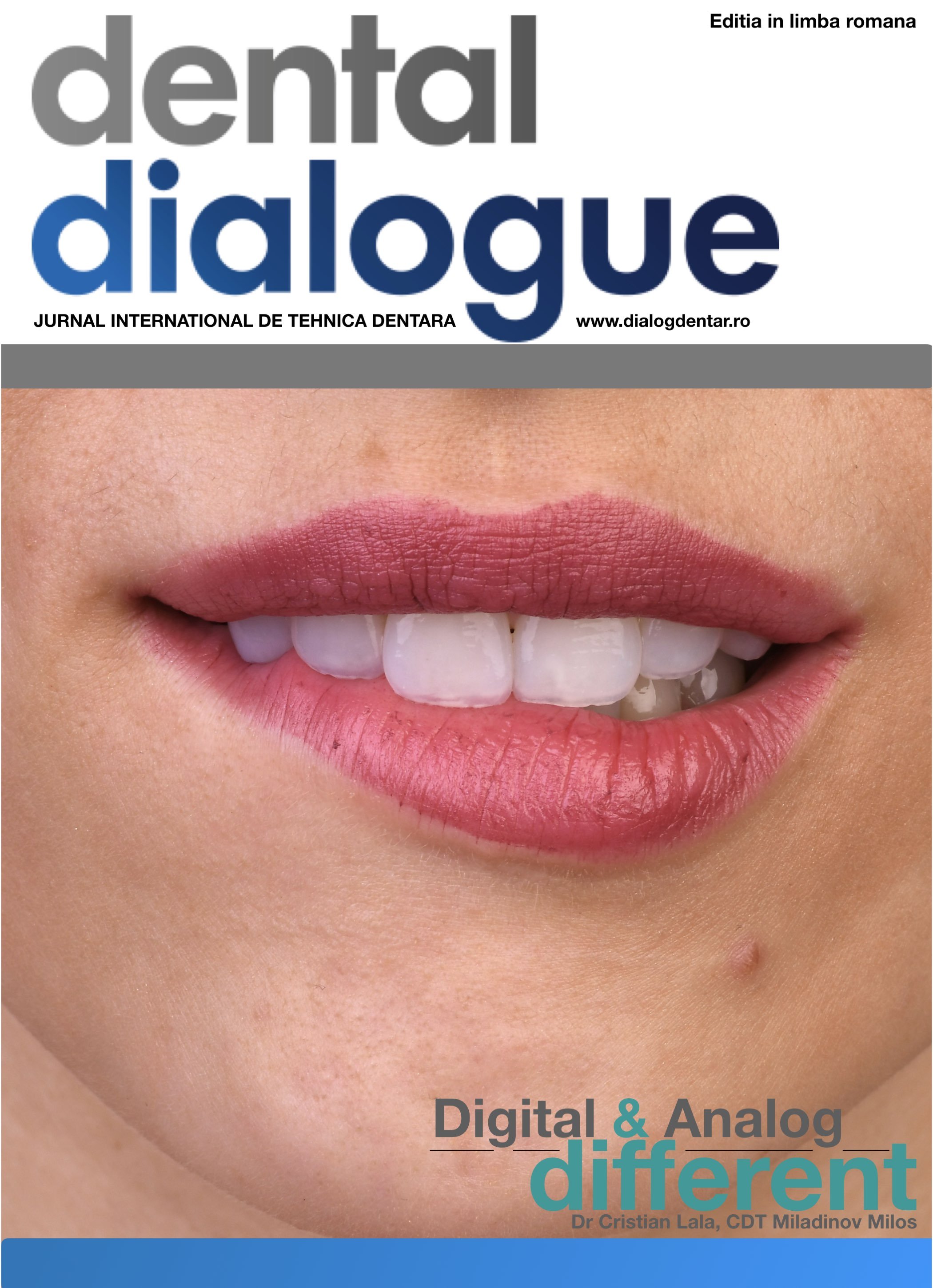 Close-up of a person's mouth showing lips, teeth, and part of the chin with a small mole. The lips are slightly parted, revealing upper and lower teeth.