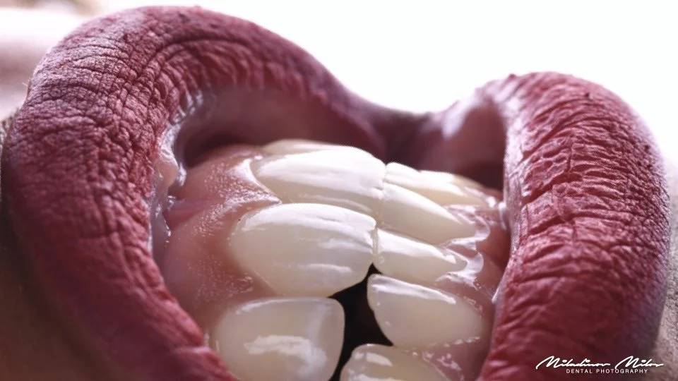 Close-up of lips painted with bright pink lipstick, parted to reveal white teeth and gums.