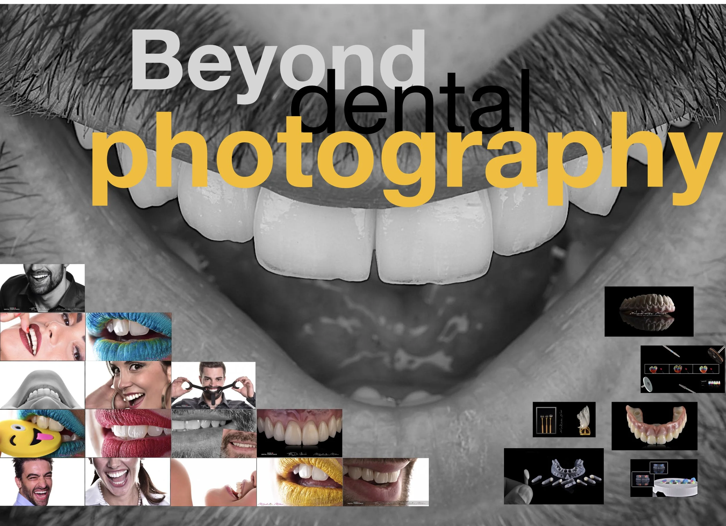 Close-up of a person's mouth with teeth, with the words 'Beyond dental' and 'photography' overlaying the image in large text.
