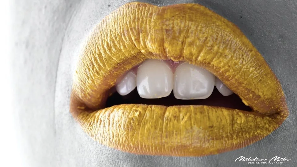 Close-up of lips with yellow lipstick, slightly parted to reveal gold and white teeth.