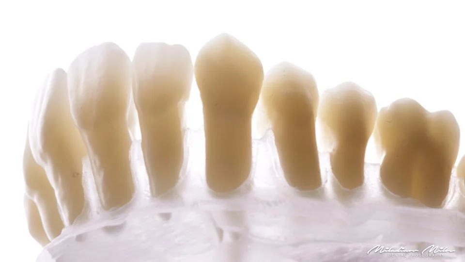 Close-up of human teeth and gums, with teeth in various stages of growth.