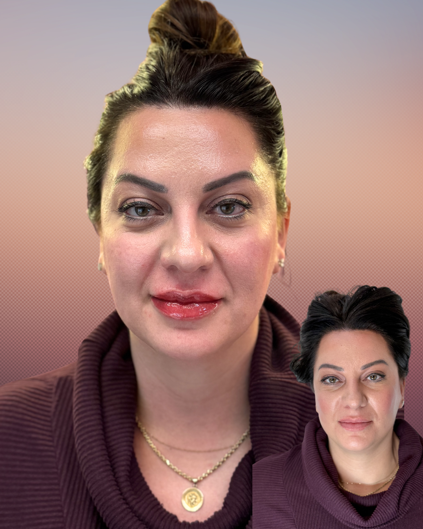 Lipseditedbeforenafter.png
