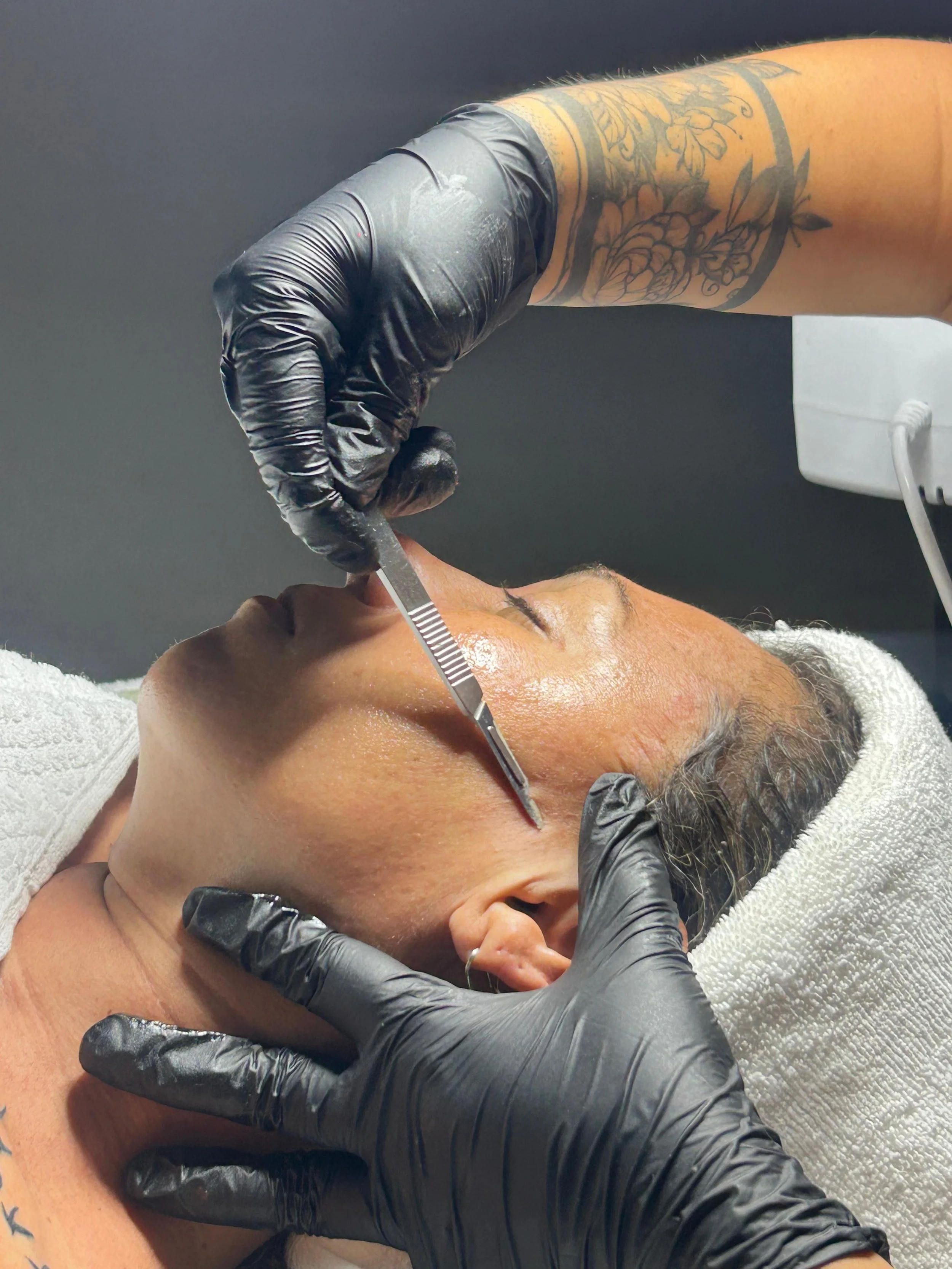 Reveal radiant skin with Dermaplaning at Salterra Wellness! Experience professional facial exfoliation for smoother, brighter skin in our luxury aesthetic suite. We offer safe, advanced skin treatments near Playas del Coco, Playa Hermosa, and Liberia
