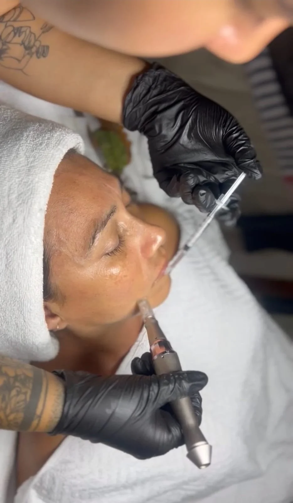 Experience Advanced Skin Regeneration at Salterra Wellness! We specialize in expert Microneedling treatments customized with Plasma-Rich Platelets (PRP), Exosomes, or Hyaluronic Acid / Vitamin C. This is the premier destination for results-driven Aes