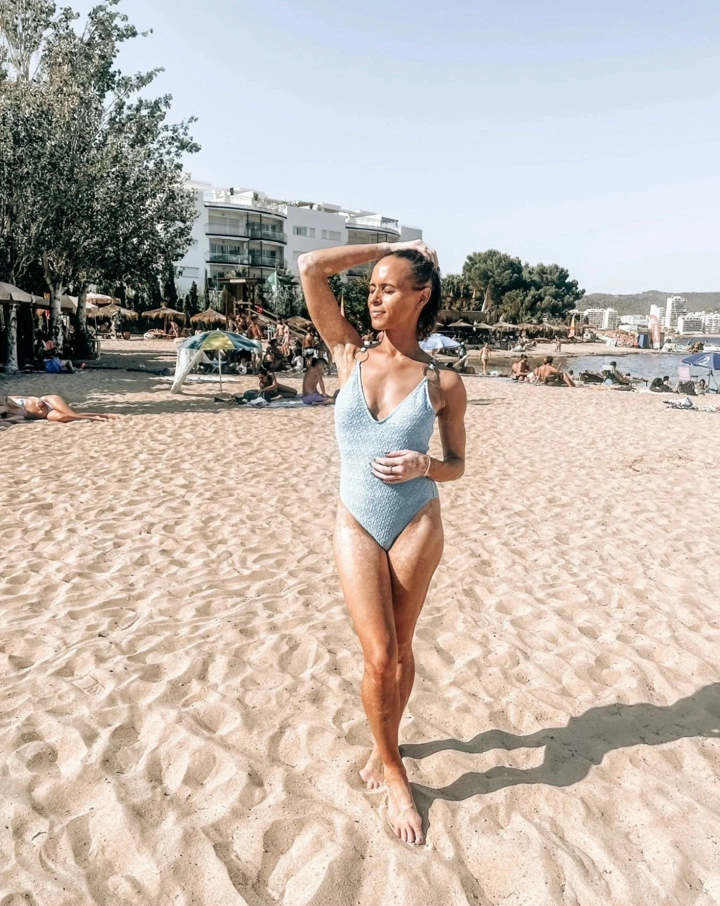 Some might say it&rsquo;s too early for a swimsuit shot&hellip;

Some vitiligo girls would disagree. Put us in a swimsuit anytime of the year because we&rsquo;re always beach ready&hellip;🌊🩵