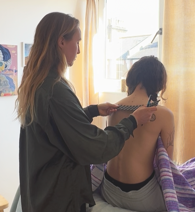 Acupuncture Treatment