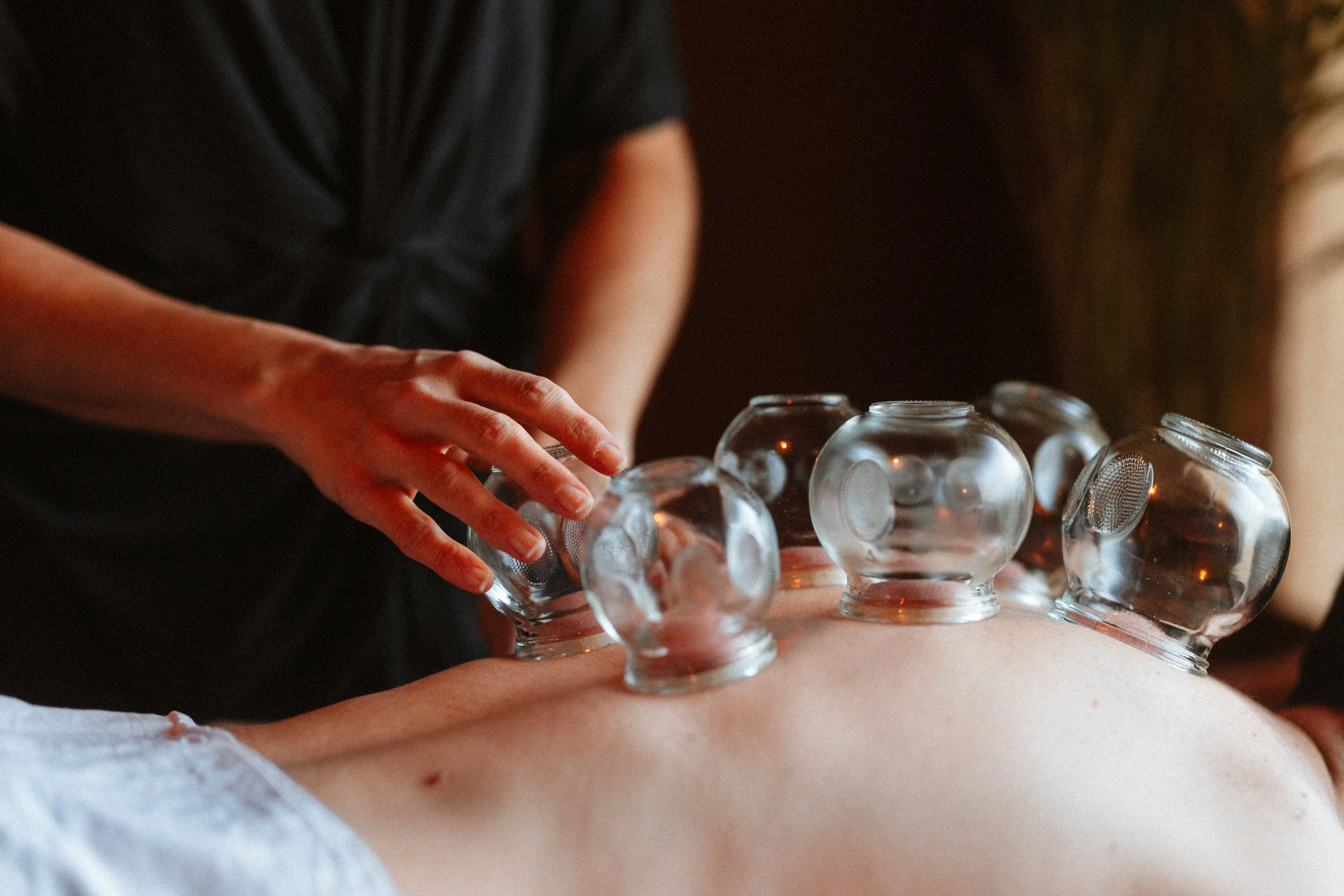 ventouse, aiguille, moxi tous les outils de la Médecine traditionnelle chinoise à sévrier