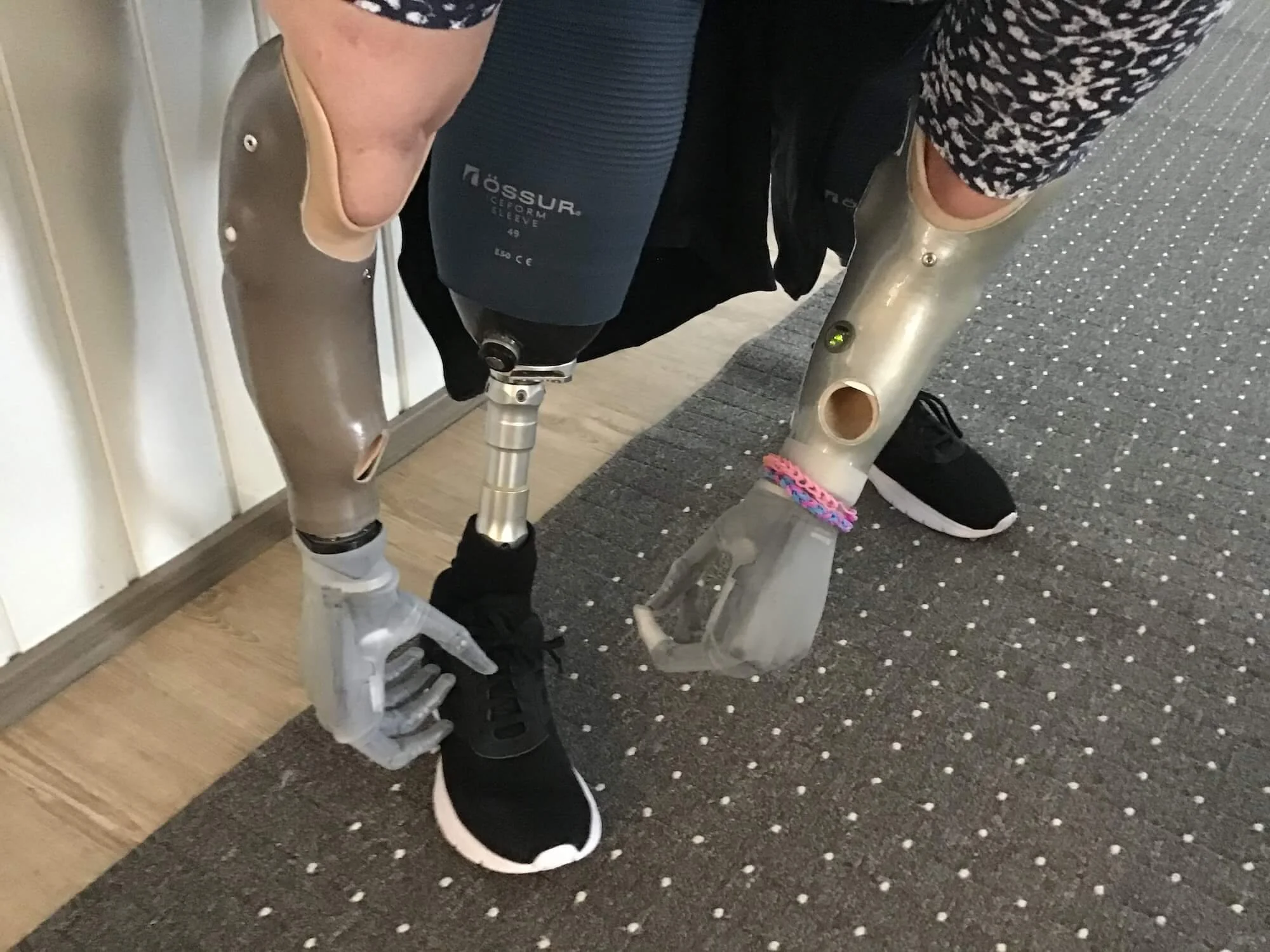 Potilasvahinkoon saatiin oikeudenmukainen ratkaisu