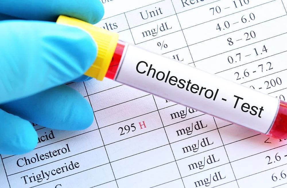 When Cholesterol Becomes the Villain Instead of the Clue - Part 2