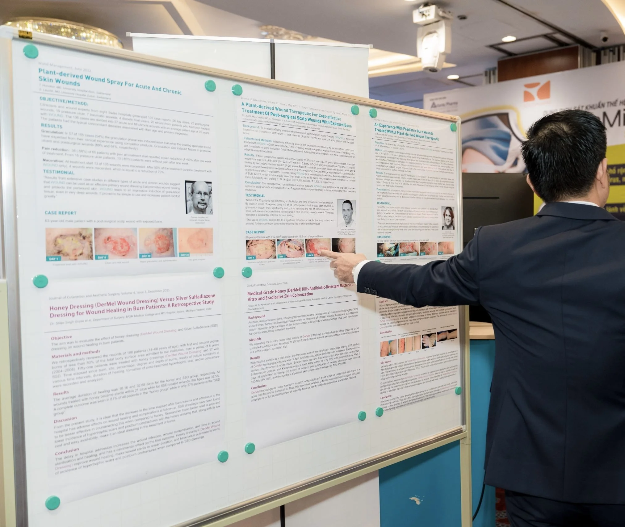A man in a dark suit points at research posters displayed on a large whiteboard at a conference. The posters include scientific images, charts, and text about wound healing studies.
