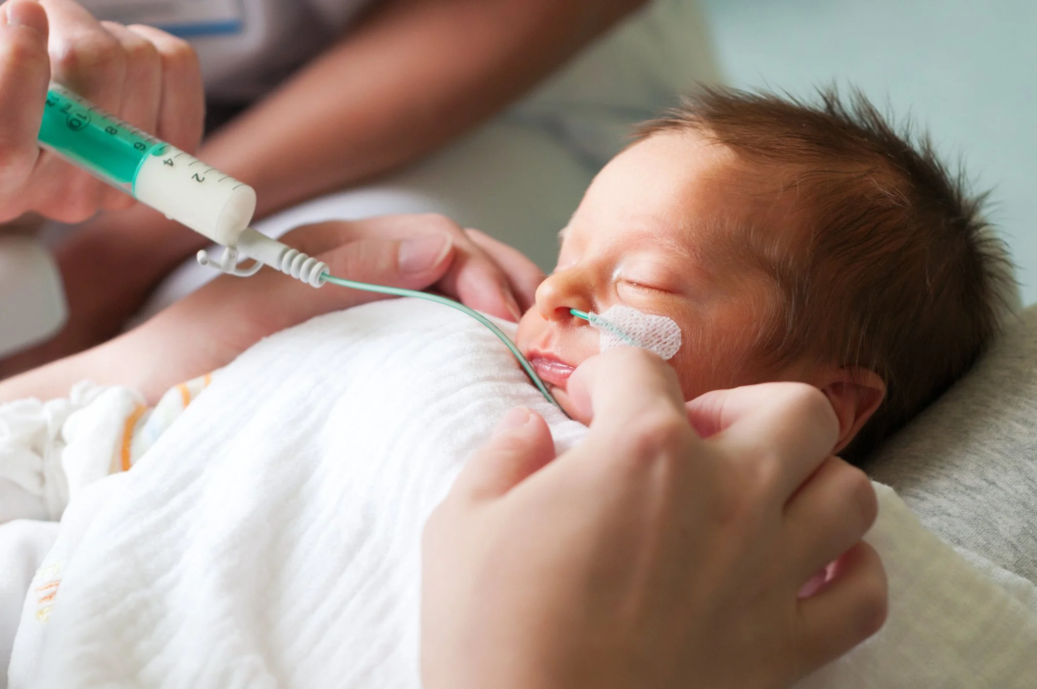 A young child with a nasogastric tube receiving medical care in a hospital, with a healthcare professional holding an IV syringe.